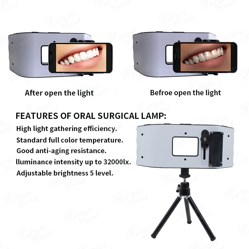 Luce flash dentale Attrezzatur - Photography Equipment recensione e prezzo